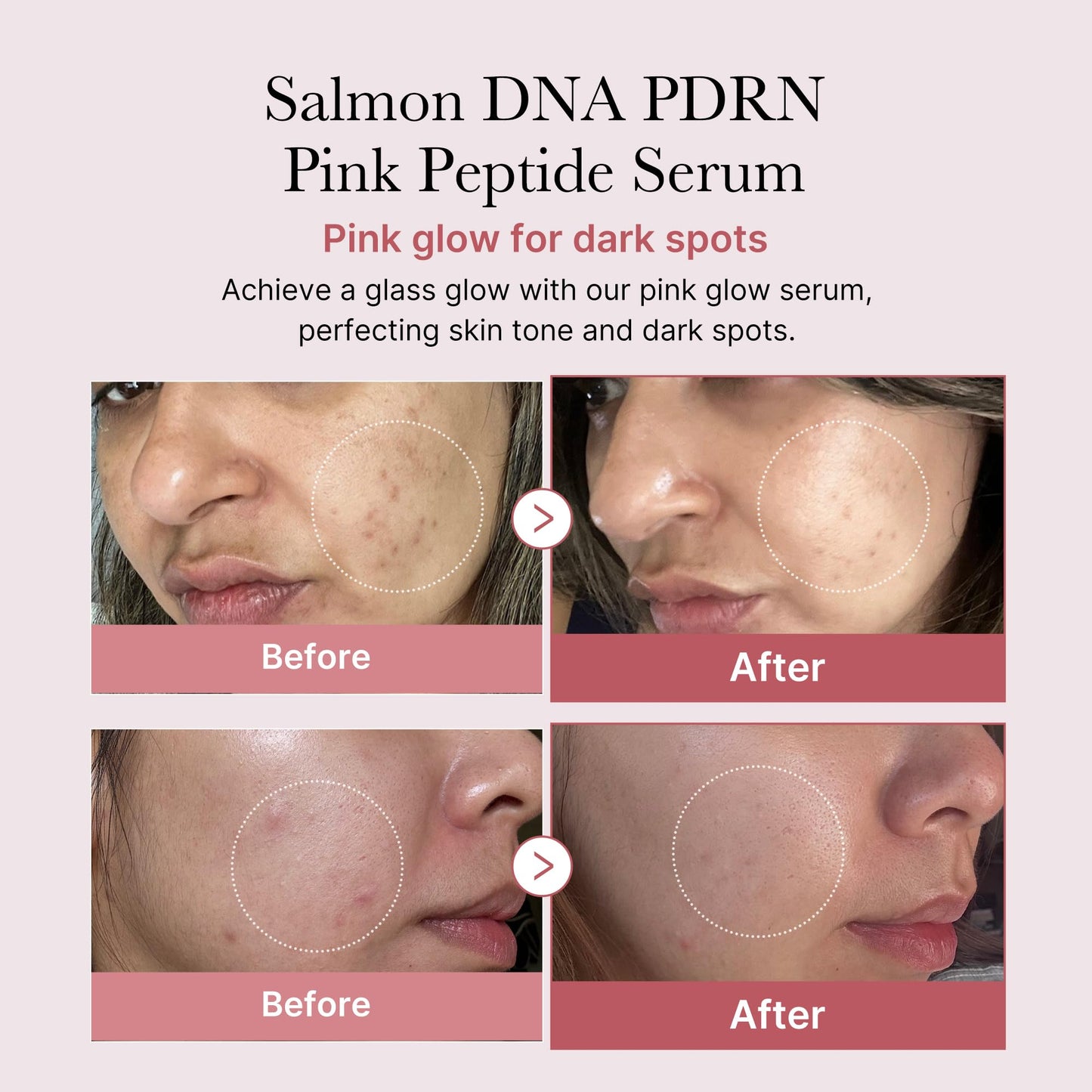 PDRN Pink Peptide Serum